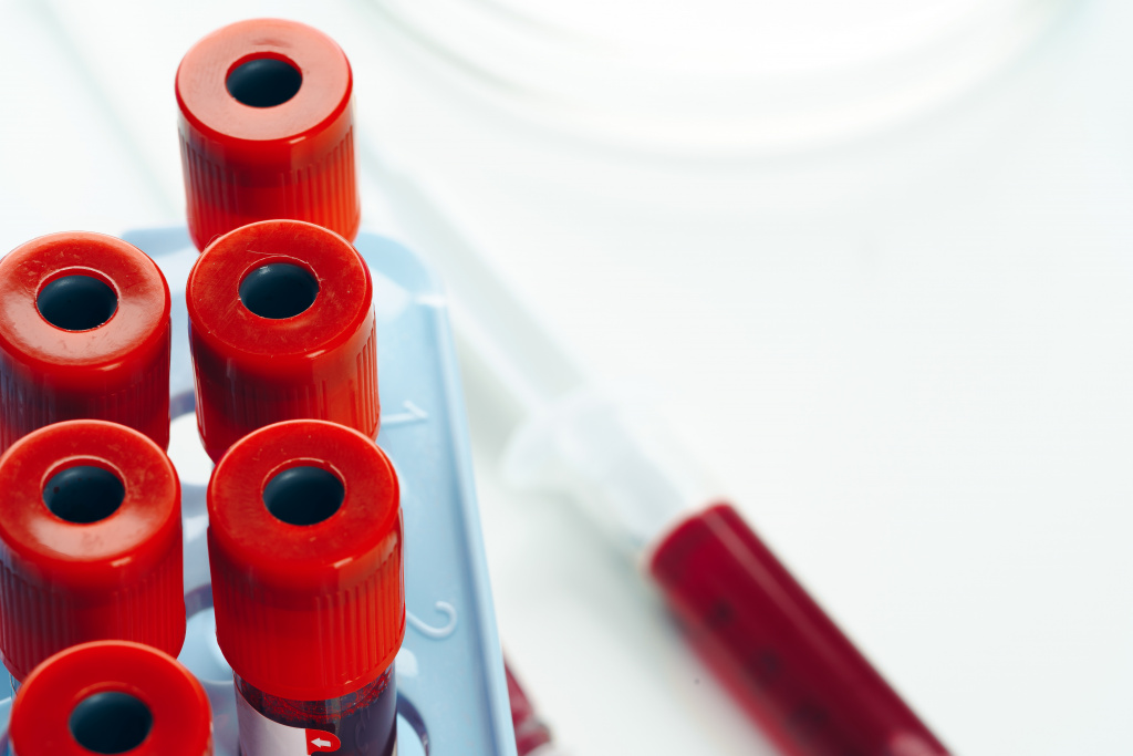 close-up-blood-test-tube-with-blood.jpg
