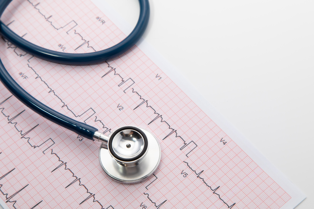blue-stethoscope-electrocardiogram-ecg-chart-paper-ecg-heart-chart-scan-isolate-white-healthcare-insurance-medical-background.jpg